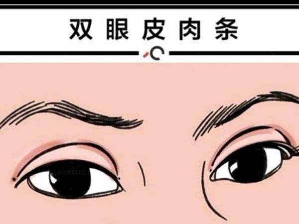 双眼皮www.jingansicbd.com