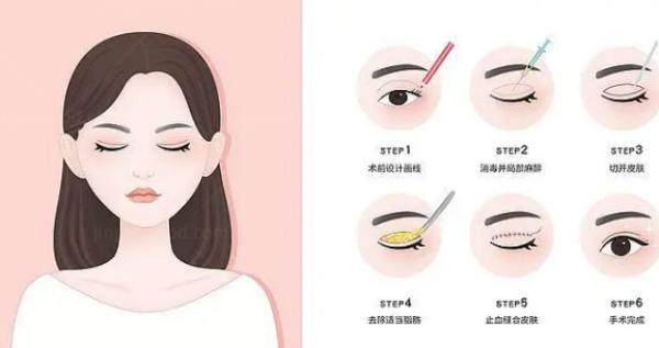 双眼皮www.jingansicbd.com