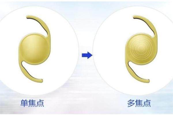 双焦点人工晶体的缺点.jpg