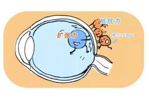 北京做后巩膜加固术多少钱www.jingansicbd.com