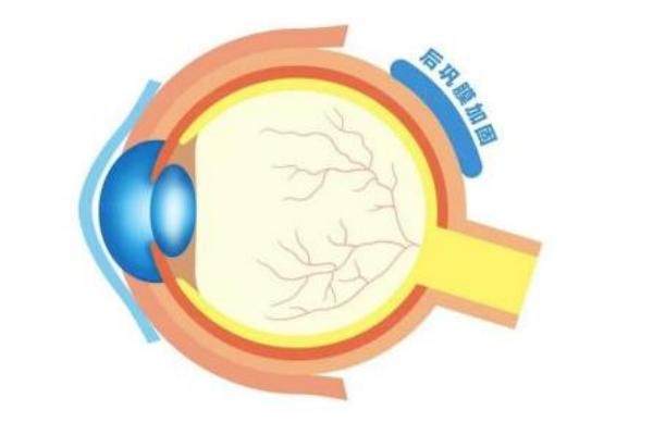 哪些医院可以开展后巩膜加固手术www.jingansicbd.com