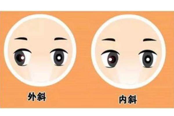 www.jingansicbd.com小儿斜视必须要做手术吗?斜视可以通过保守治疗或手术来治疗.jpg