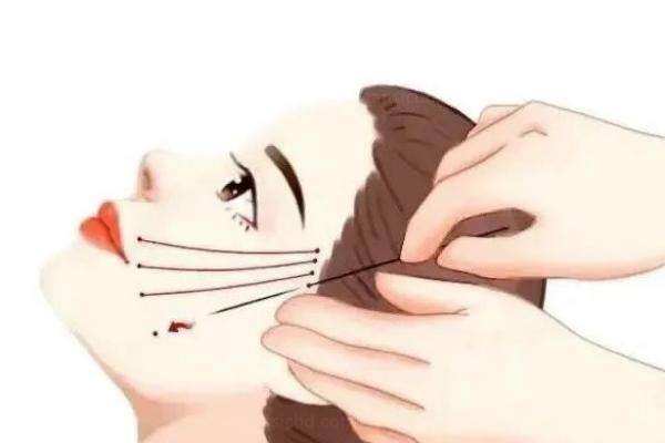 北京祝东升面部提升
