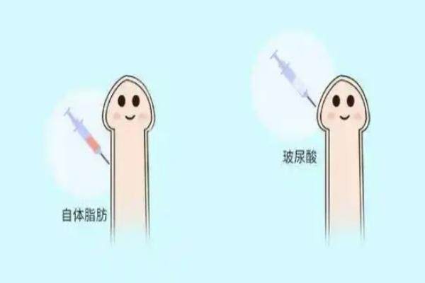 生物补片增粗手术多少钱