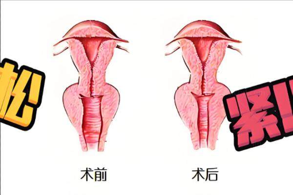 私密整形手术有哪些.jpg