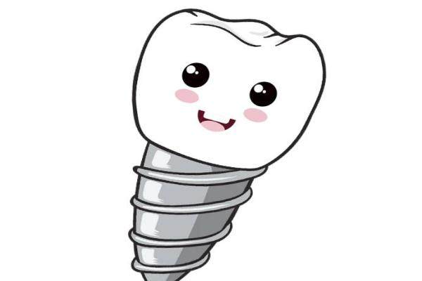 韩国牙齿种植体价格表