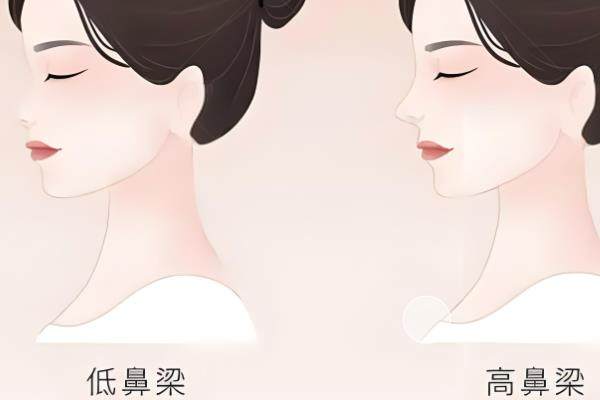 鼻修复手术一般多少钱?假体调整8k+/隆鼻修复12w+/挛缩修复4.8w+.jpg