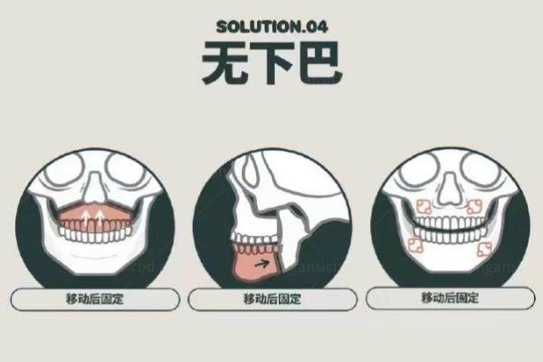 双鄂整形医院排行榜前十名