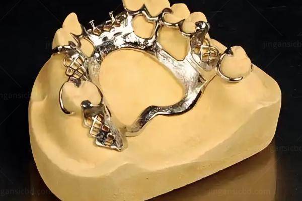 维他灵和纯钛支架哪种好 维他灵和纯钛支架哪种好