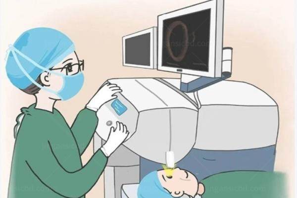 全飞秒近视手术的危害及后遗症