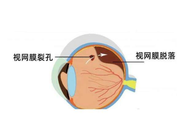 黄斑区受损还能<span style=