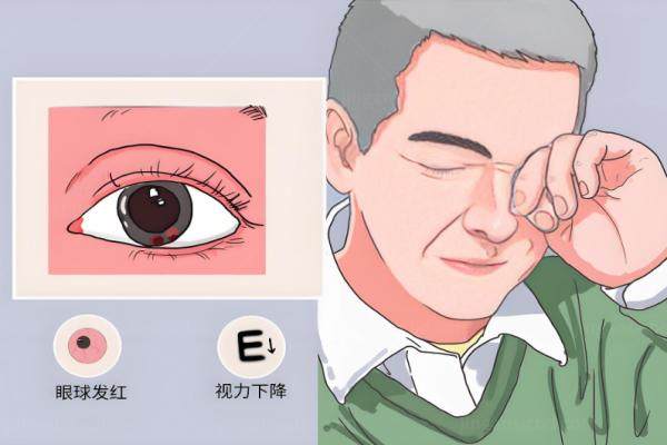 人工虹膜植入治疗眼球震颤.jpg