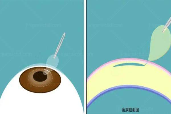 跃无极晶体的近距离看得清楚吗.jpg