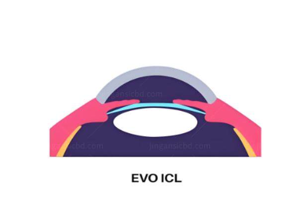 蔡司三焦点晶体能解决多少度近视?.jpg 蔡司三焦点晶体能解决多少度近视?.jpg