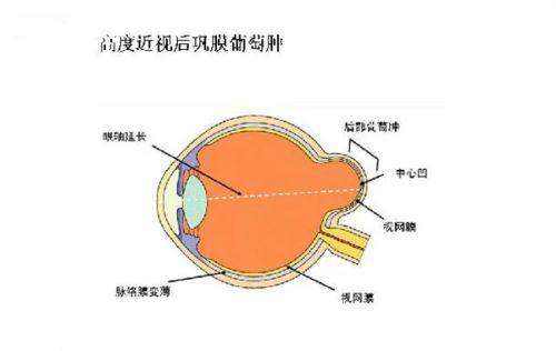 二、吉大二院眼科吴荒出诊时间