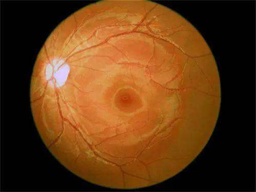 天水爱尔眼科医院上班时间:全年无休随时就诊!附医院地址和简介