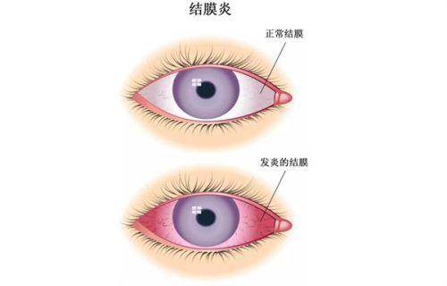 二、艾维眼科医院是正规医院吗？