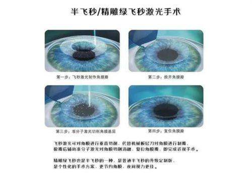 成都普瑞眼科周继容怎么样?26年经验,数万例手术成功例!速览医生简介!