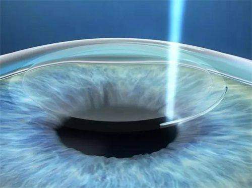 龙岩华厦眼科医院位置在哪里？揭秘其详细地址及周末是否上班，眼病患者必看！