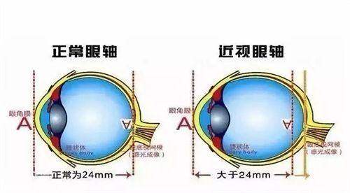 郑州眼科王卫群怎么样？擅长多种眼科手术医术好，典型案例反馈效果超赞！