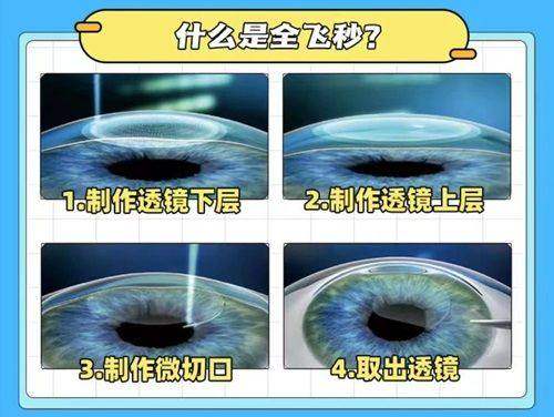 二、眼底病主要包括哪几种?