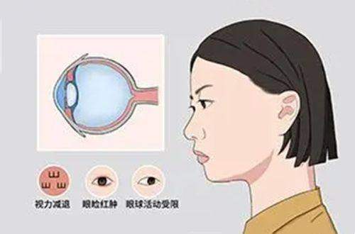 西安四院眼科近视手术过年放假吗？春节门急诊照常接诊，速来了解过年可以去吗？