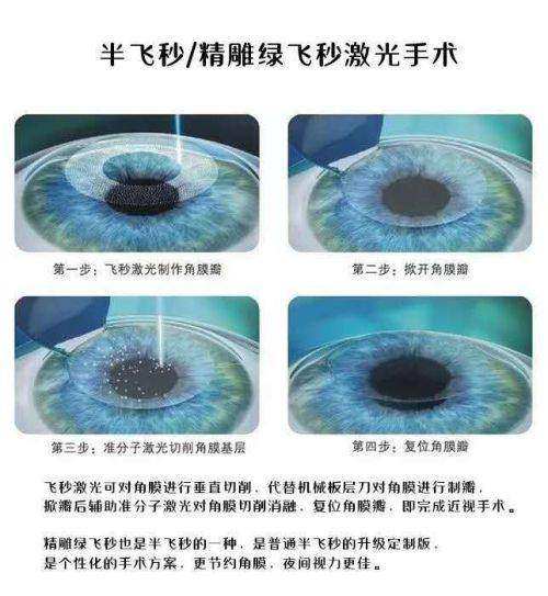 二、重庆南岸爱成眼科医院技术怎么样
