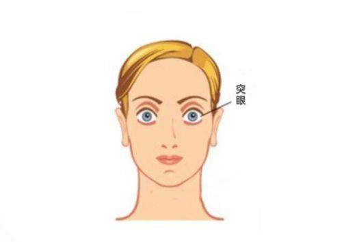 廉井财做眼睛手术靠谱不？当然靠谱！从业30年无事故，做近视手术超厉害！