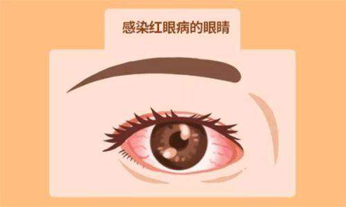 高度近视叶剑医生在哪家医院看？主要坐诊在重庆华厦渝州眼科专注高度近视只要2万起