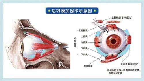 一、晋江梅岭艾仕瞳眼科怎么样正规吗