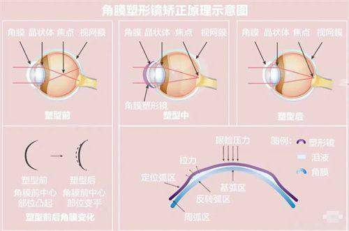 贵阳佰视佳眼科医院医保报销吗？报销情况依项目而定，专业眼科服务质量高，医保报销有保障