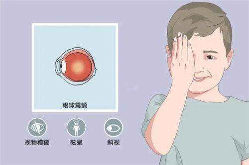 成都新视界眼科医院做近视手术怎么啊有做过的吗？价格合理，专业团队与先进技术保障术后视力清晰恢复佳