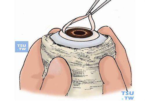 小结：手术费高低，关键看这几点！chike.jingansicbd.com