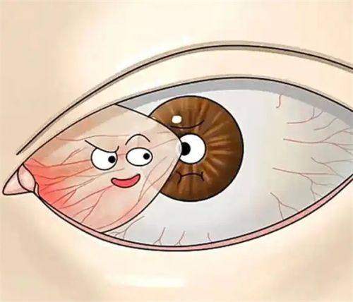 2026黄斑病变手术费多少钱？黄斑前膜手术5k/老年性黄斑变性手术5k~3W