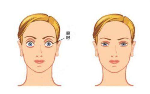 福州东南眼科医院坐地铁2号线宁化站哪个出口？D出口！300米到台江35号医院正门。