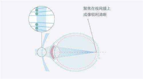 北京圣康华眼科医院是公立吗？属正规专科收费透明，技术精湛护航全龄眼健康值得托付