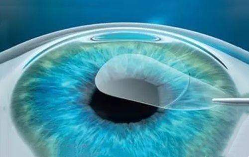 二、北京眼科医院的资质与设备查询chike.jingansicbd.com