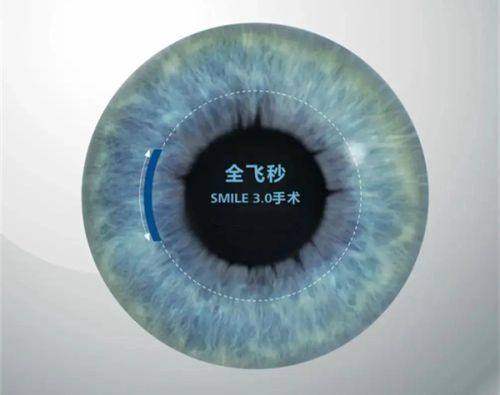 二、驻马店尖峰眼科医院靠谱吗?chike.jingansicbd.com