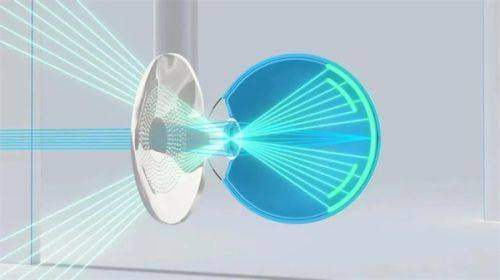 哈尔滨焦视做青光眼怎么样？正规机构难寻，建议选哈医大权威专家与先进设备安心诊疗