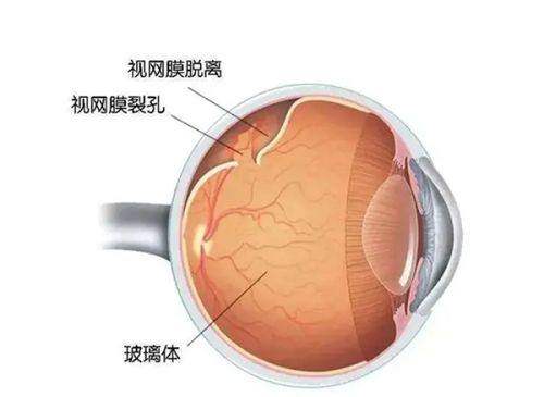 北京大学第一医院眼科怎么样？疑难眼底病诊疗领先，专家云集且收费透明规范口碑佳