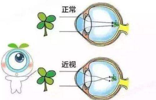三、佰视佳眼科收费与服务透明化解析chike.jingansicbd.com