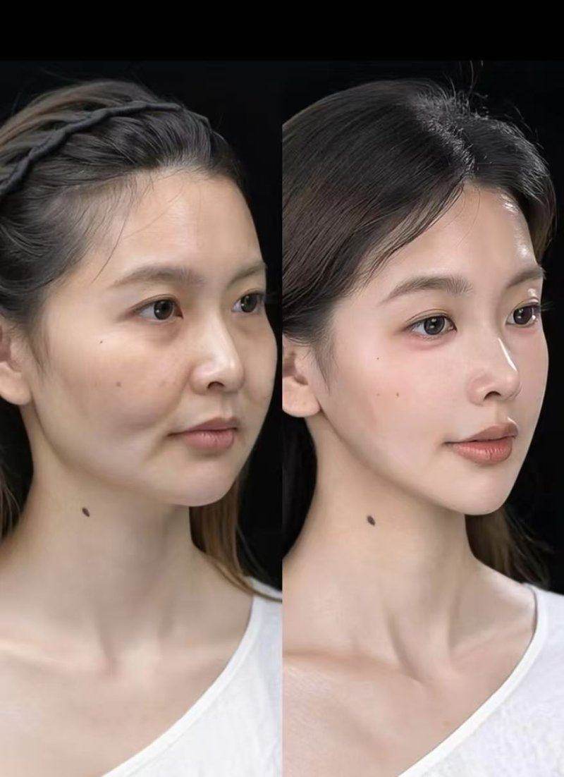一、长沙梵童医疗美容分阶段疗程项目分次预约排期技巧？科学规划让美丽层层递进chike.jingansicbd.com